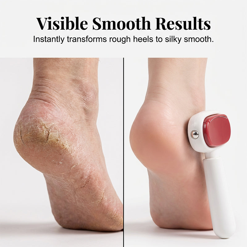 TYIIPLUS™ Double-Sided Foot Scraper – Easily Removes Calluses and Dead Skin ✨🦶